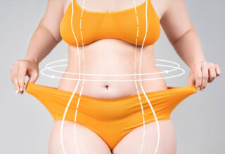 Liposuction Nedir? Hakkında Bilmeniz Gerekenler